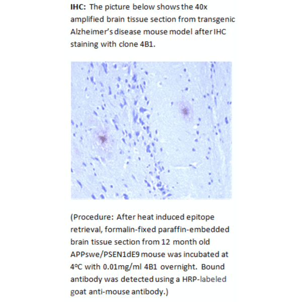 mo m40095c ihc large 2.png