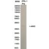 pdl 1 10b12.jpg