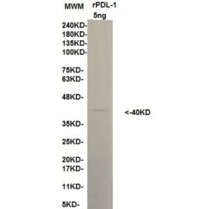 pdl 1 10b12.jpg