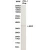 pdl 1 11d11.jpg