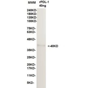 pdl 1 11d11.jpg
