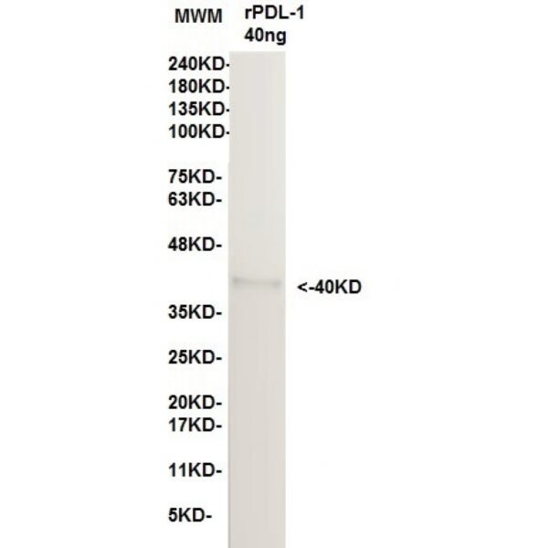 pdl 1 11d11.jpg