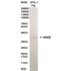 pdl 1 12b4 1ng.jpg