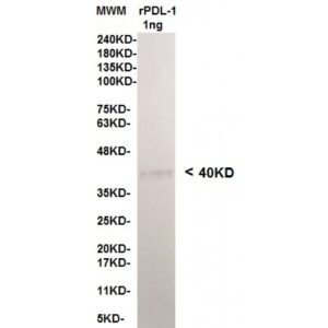 pdl 1 12b4 1ng.jpg