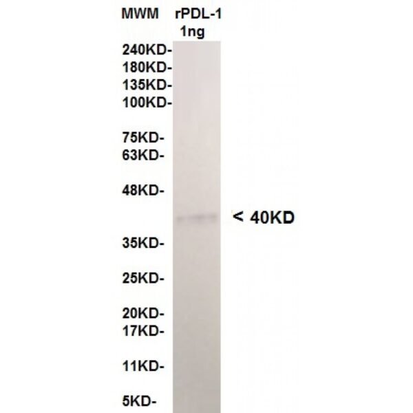 pdl 1 12b4 1ng.jpg