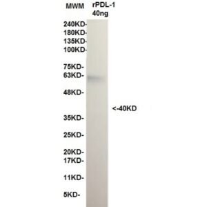 pdl 1 12d9.jpg