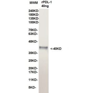 pdl 1 15f2.jpg