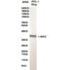 pdl 1 15g3.jpg