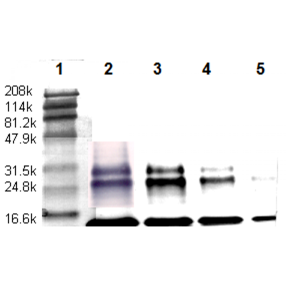 tgfb tb21 wb.png tgfb tb21 wb.png